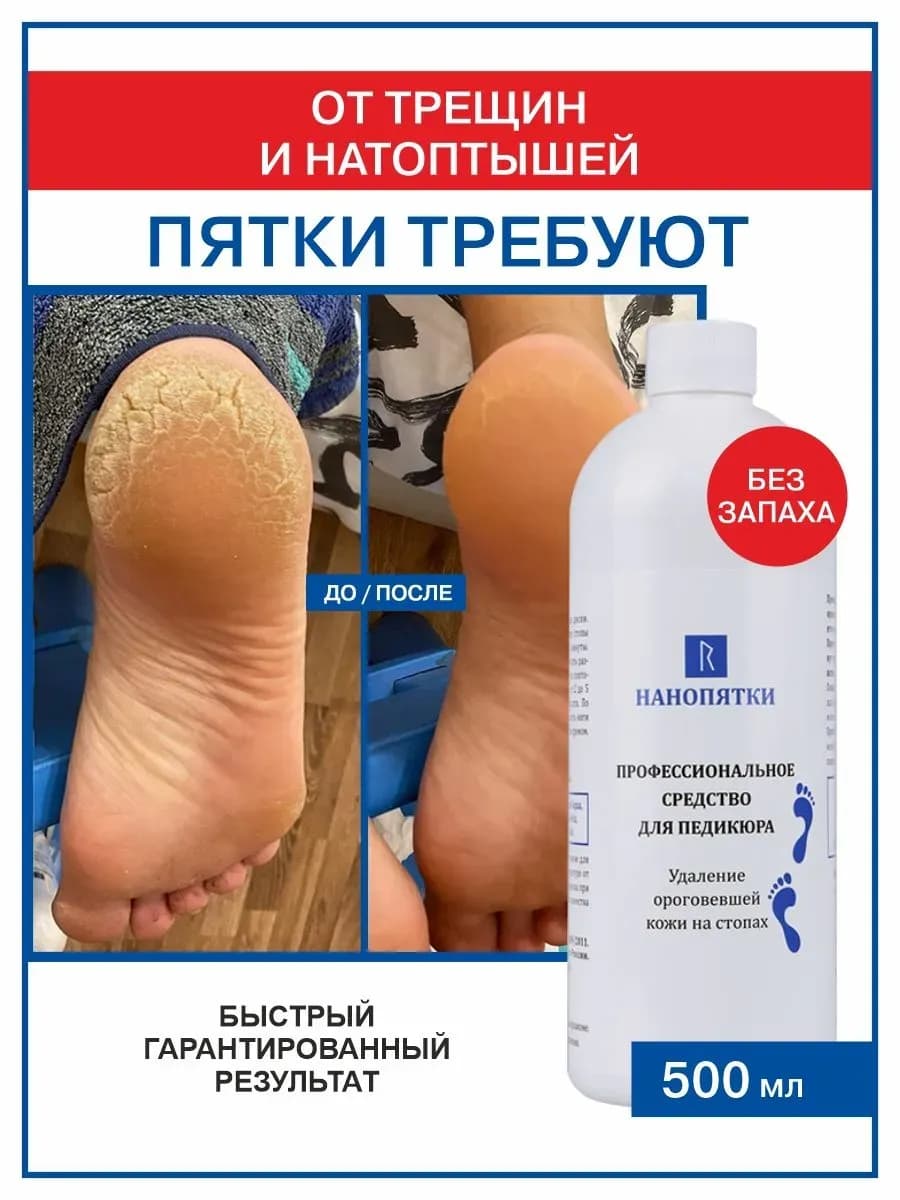 Жидкое лезвие. Средство для гладких пяток