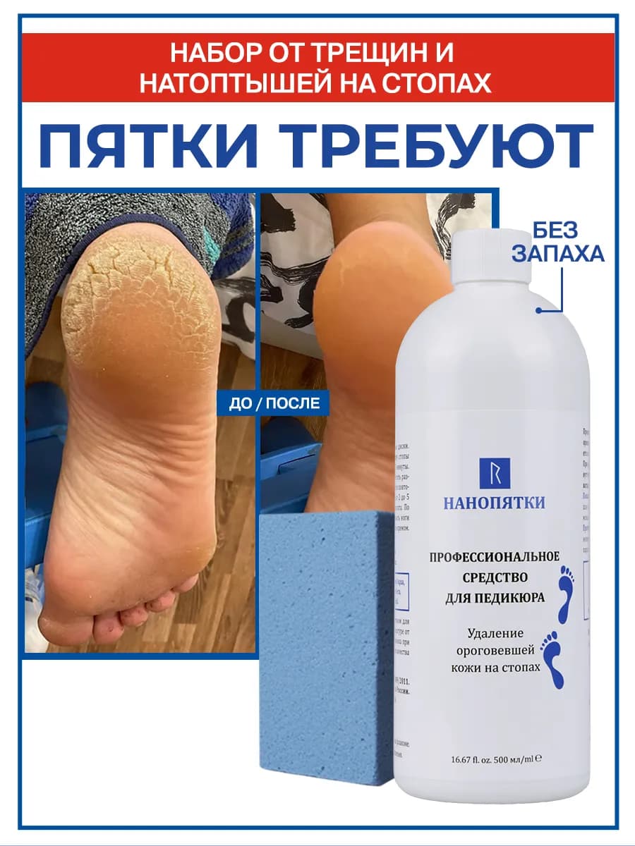 Набор для пяток от трещин - фото 1