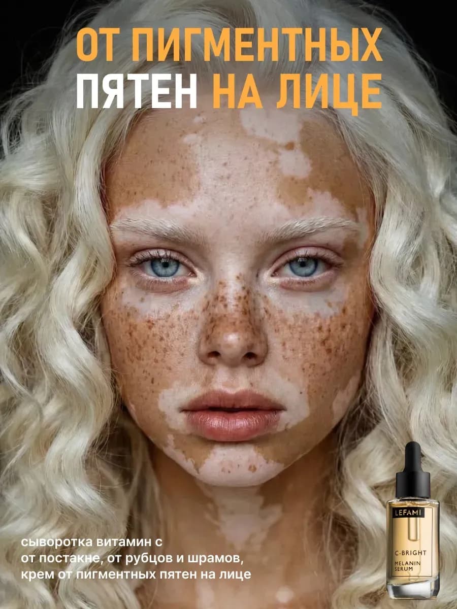 Отбеливающее средство от пигментных пятен на лице