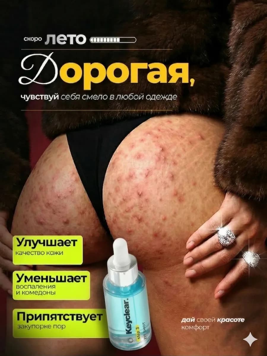 Сыворотка с ниацинамидом от прыщей и черных точек - фото 1