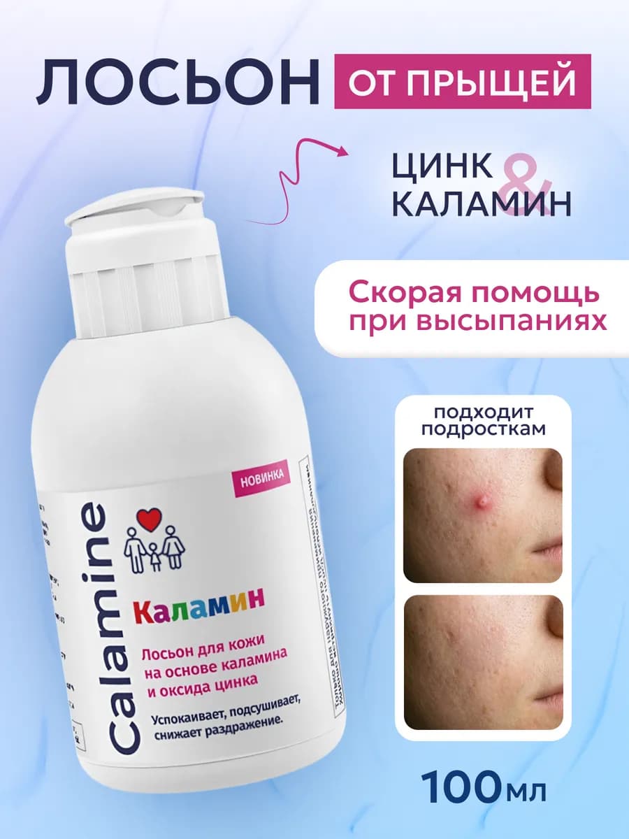 Каламин лосьон-средство от прыщей на лице и теле для подрост…