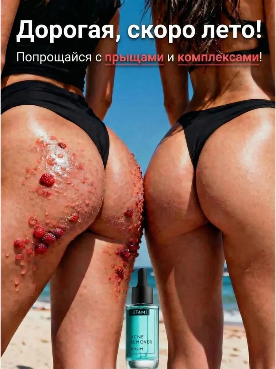 Сыворотка для лица с ниацинамидом от прыщей и акне