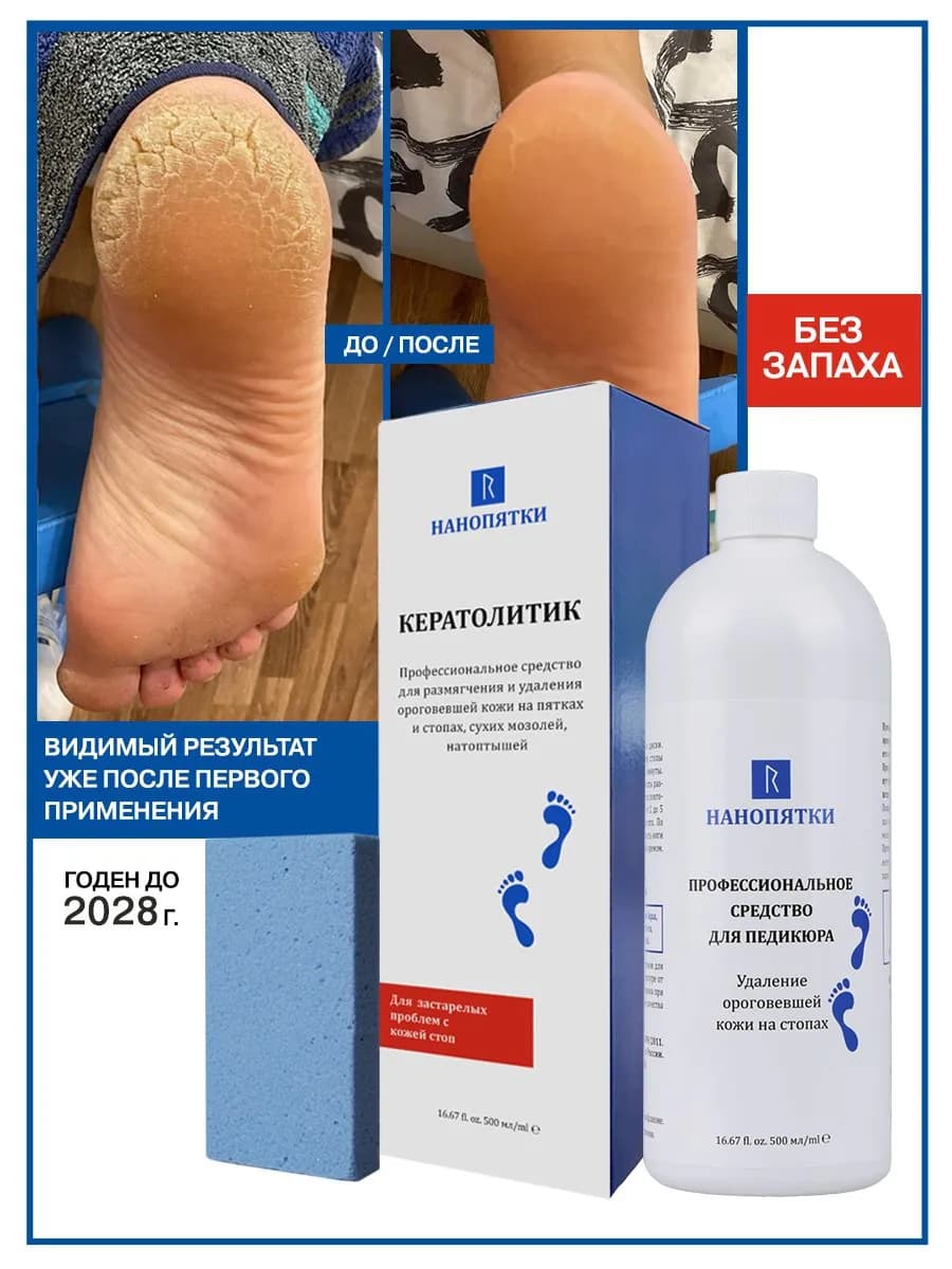 Средство для педикюра от грубой кожи на пятках