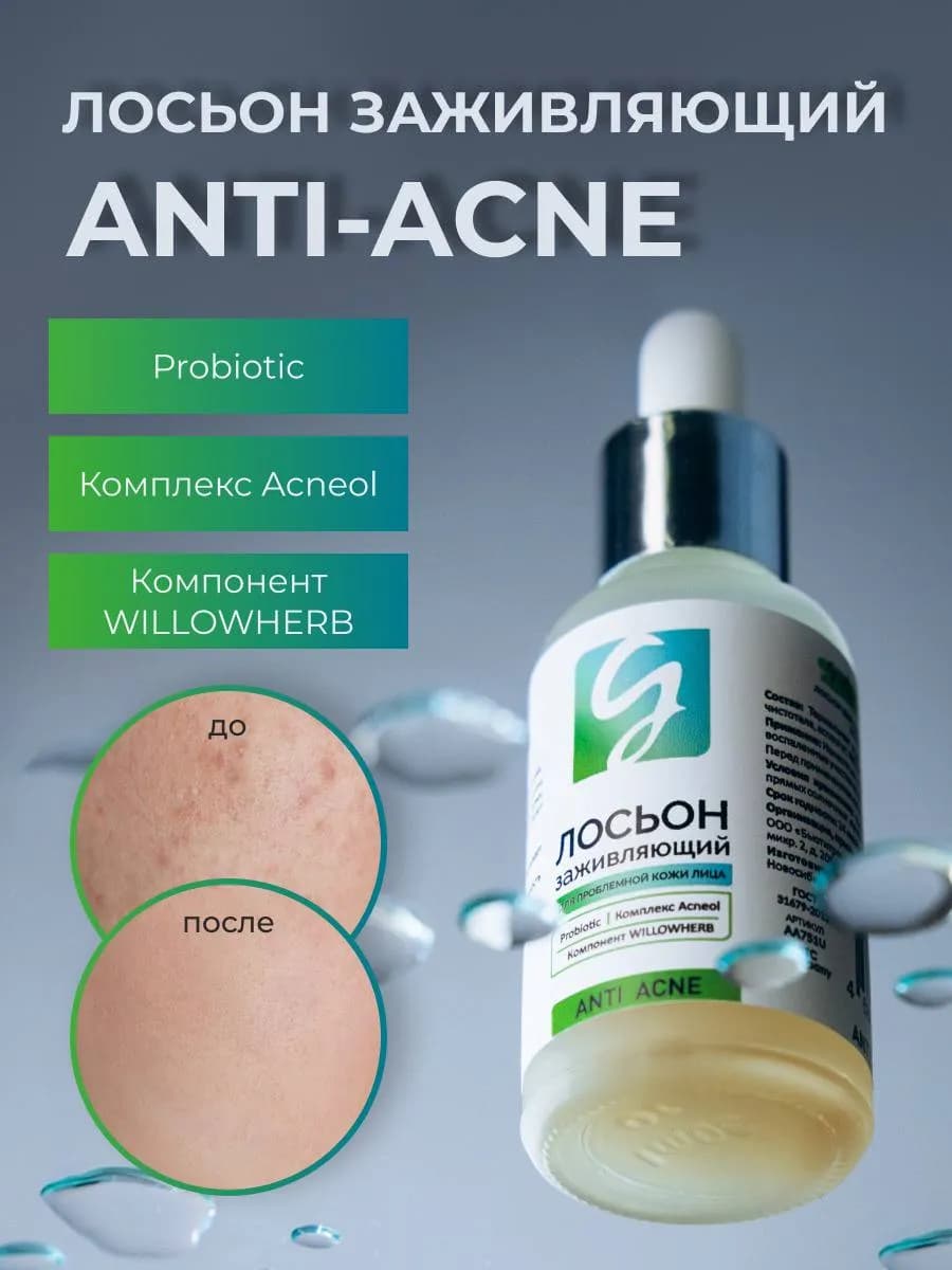 Лосьон для лица от прыщей