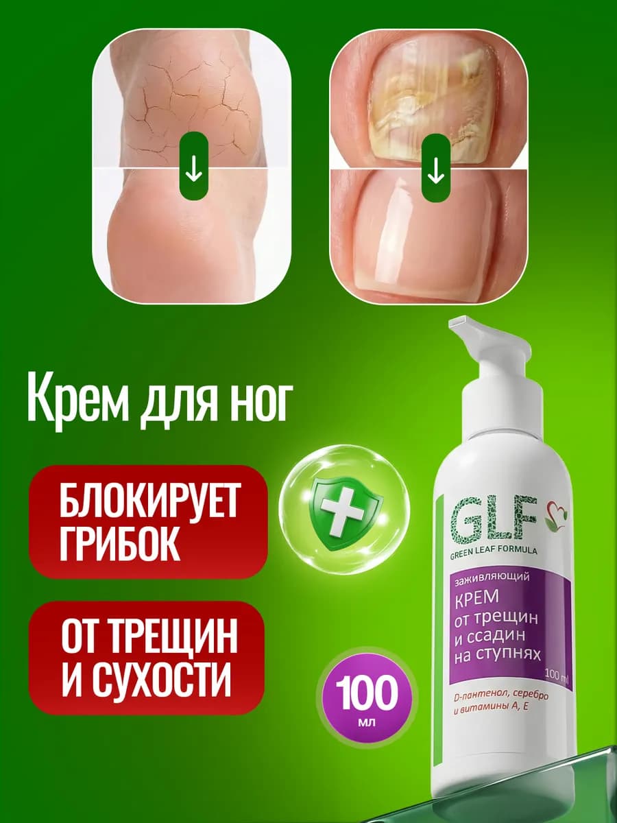 Крем для ног от трещин и грибка заживляющий