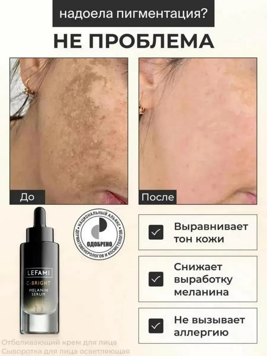 Сыворотка для лица от пигментных пятен увлажняющая отбеливаю…