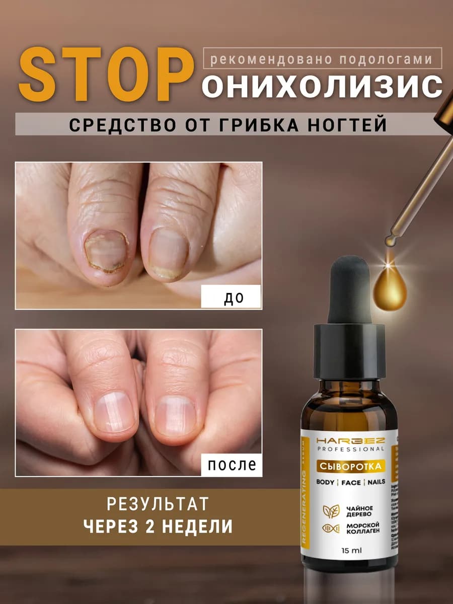 Средство от грибка ногтей стоп онихолизис 15 мл - фото 1