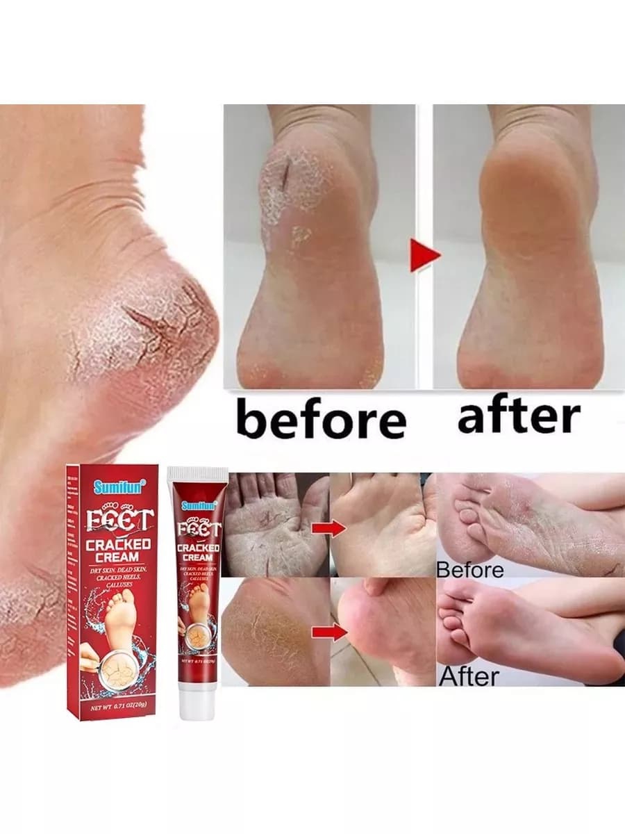 Крем для ног от сухой кожи