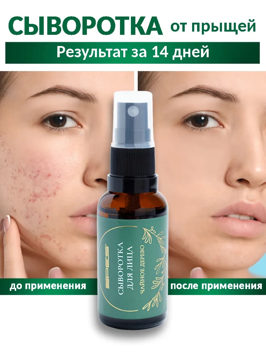 Сыворотка для лица от прыщей акне постакне - фото 1