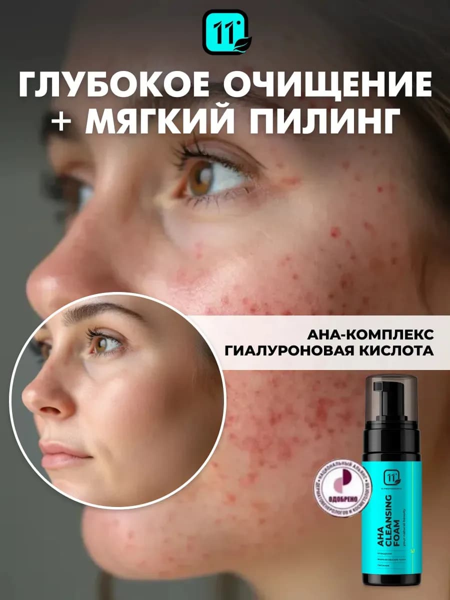 Пенка для умывания лица от прыщей. Отшелушивающая и увлажняю…