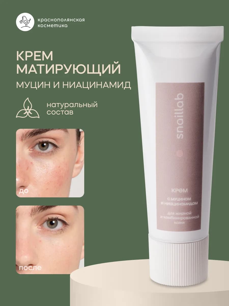 Антивозрастной крем от прыщей с муцином улитки - фото 1