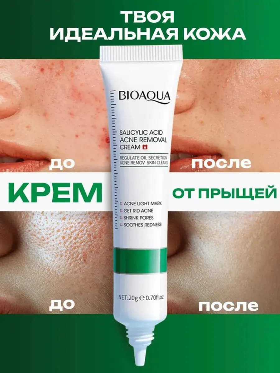 Крем против акне с салициловой кислотой