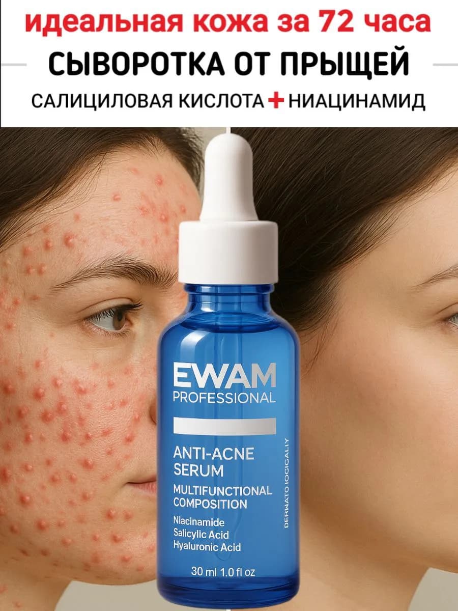 Крем сыворотка от прыщей и акне для лица - фото 1