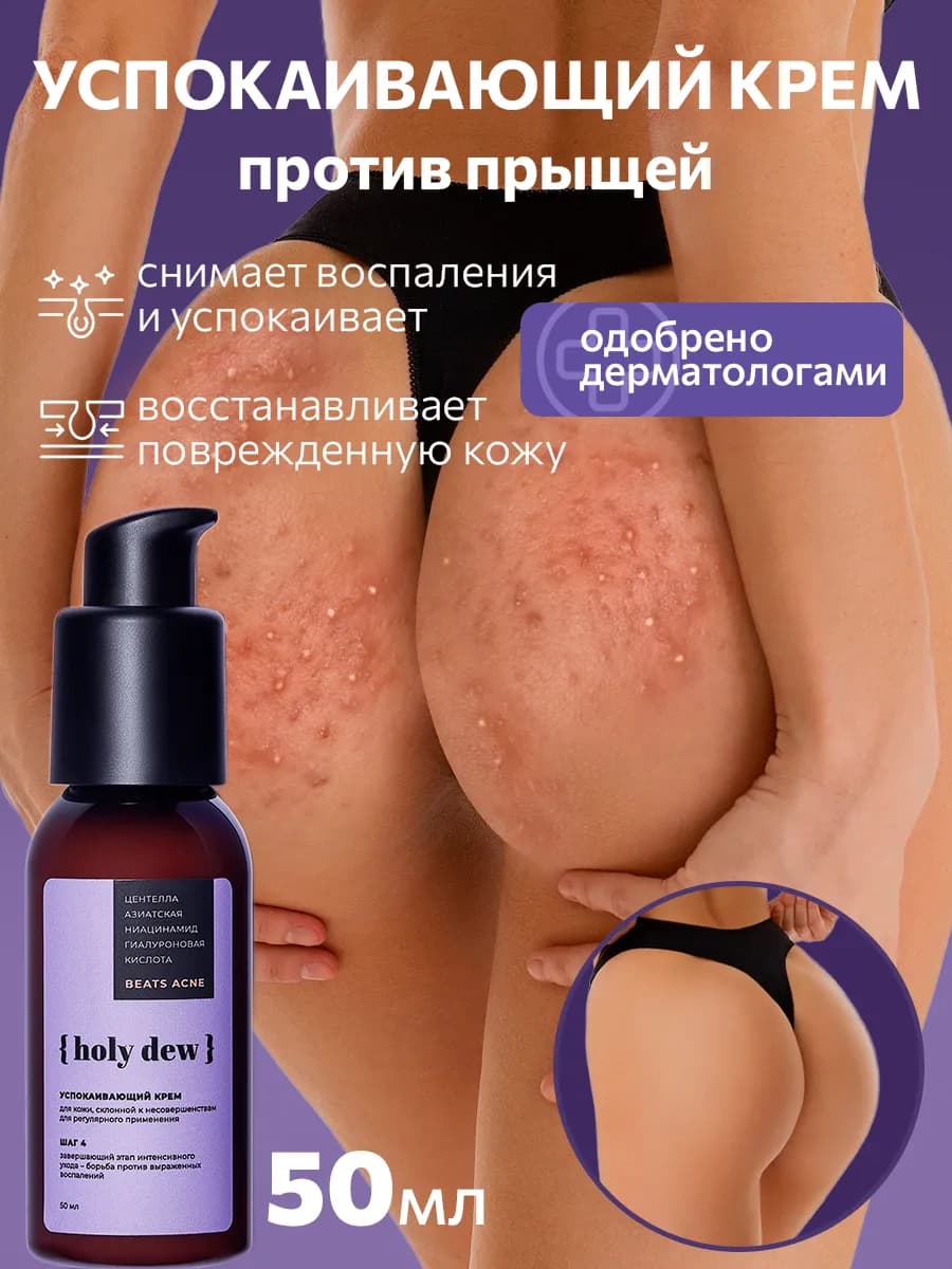 Крем для лица и тела от прыщей успокаивающий, 50 мл