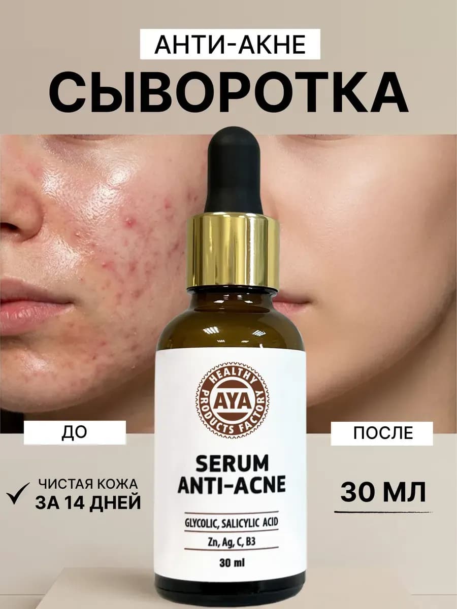Сыворотка для лица от прыщей и акне с ниацинамидом
