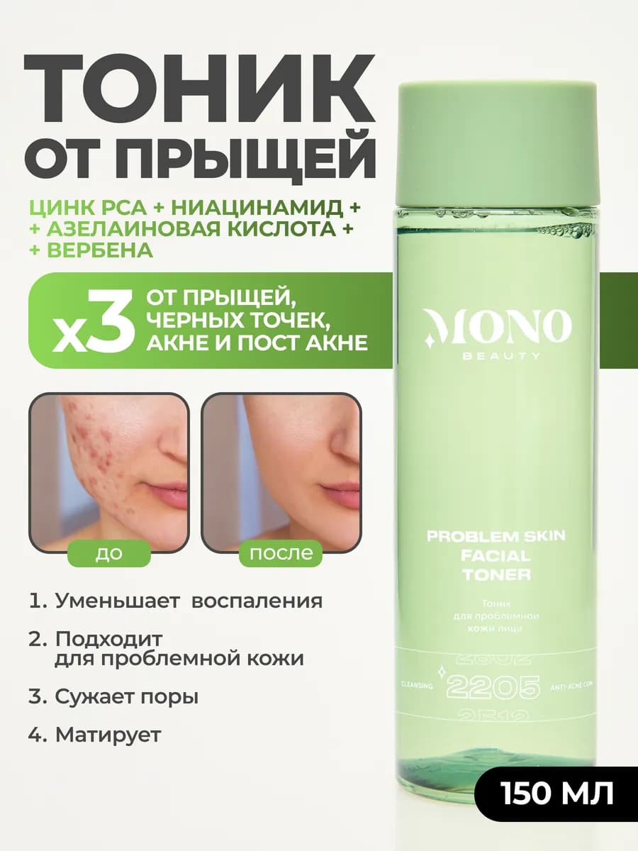 Тоник для лица от прыщей и черных точек матирующий