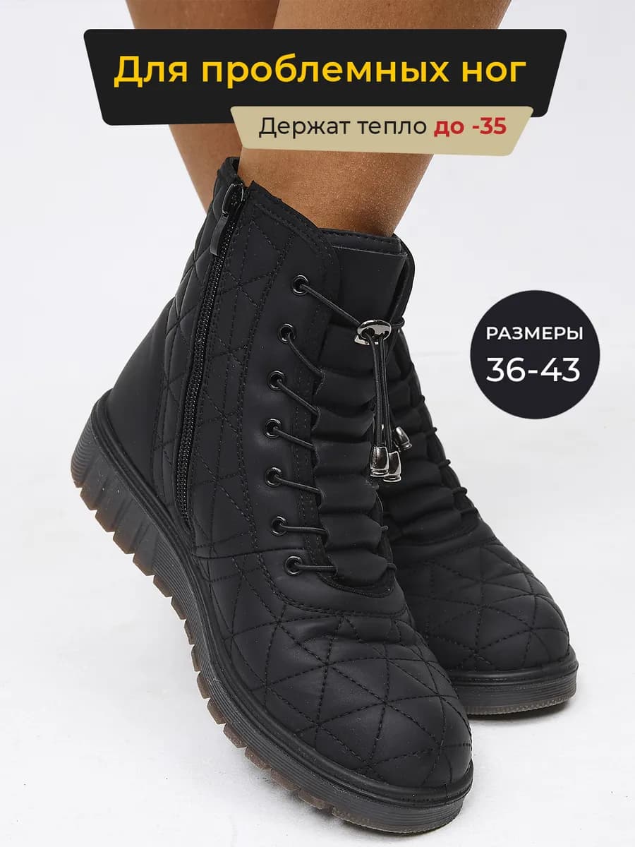 Ботинки женские зимние для проблемных ног - фото 1