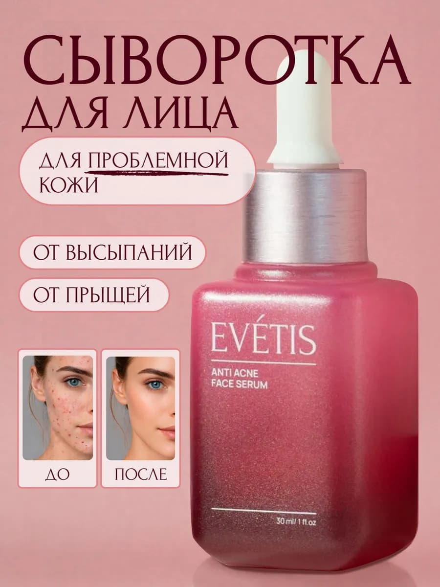 Сыворотка для лица от прыщей и акне с ниацинамидом