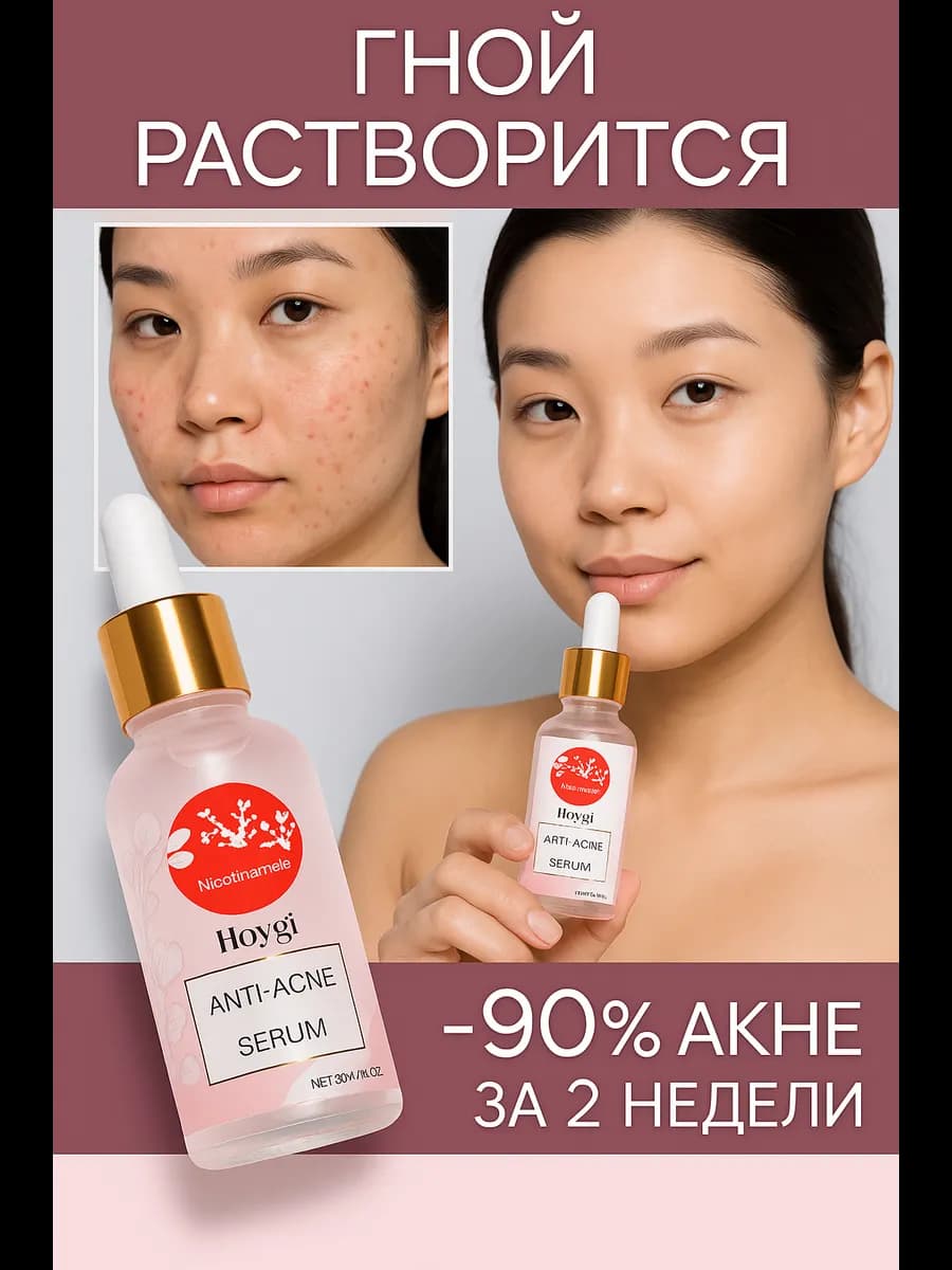Сыворотка для лица от прыщей