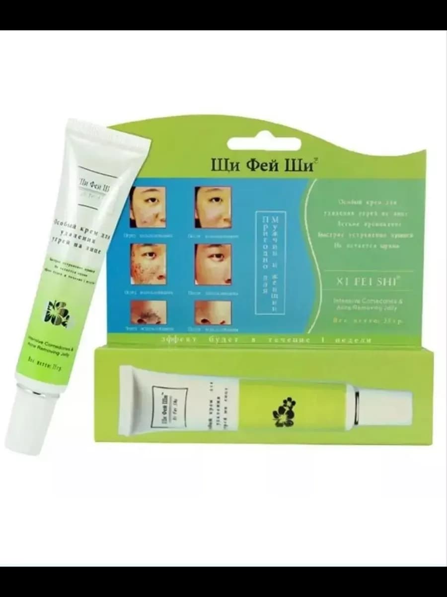 Крем от прыщей - акне и угревой сыпи на лице и теле