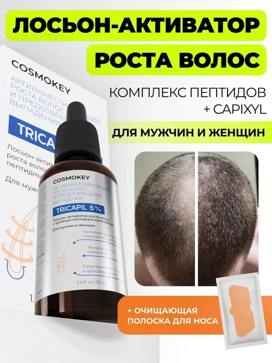 Сыворотка для роста волос на голове у мужчин и женщин