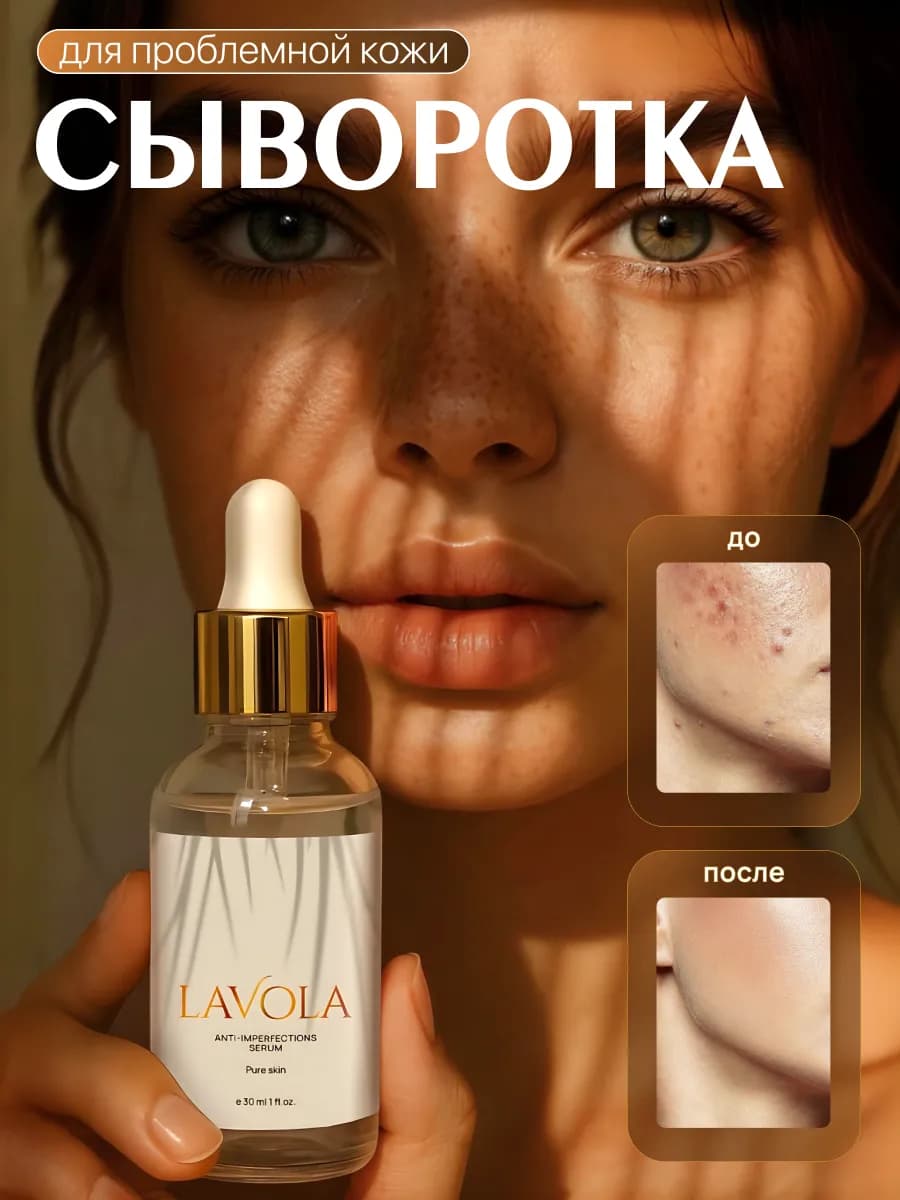 Сыворотка для лица от прыщей и акне 30 мл