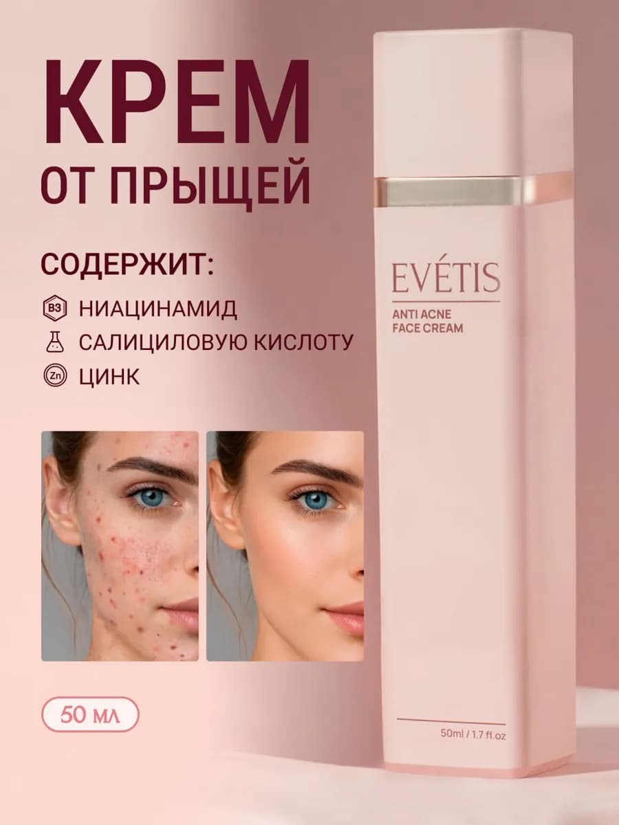 Крем для лица от прыщей и акне