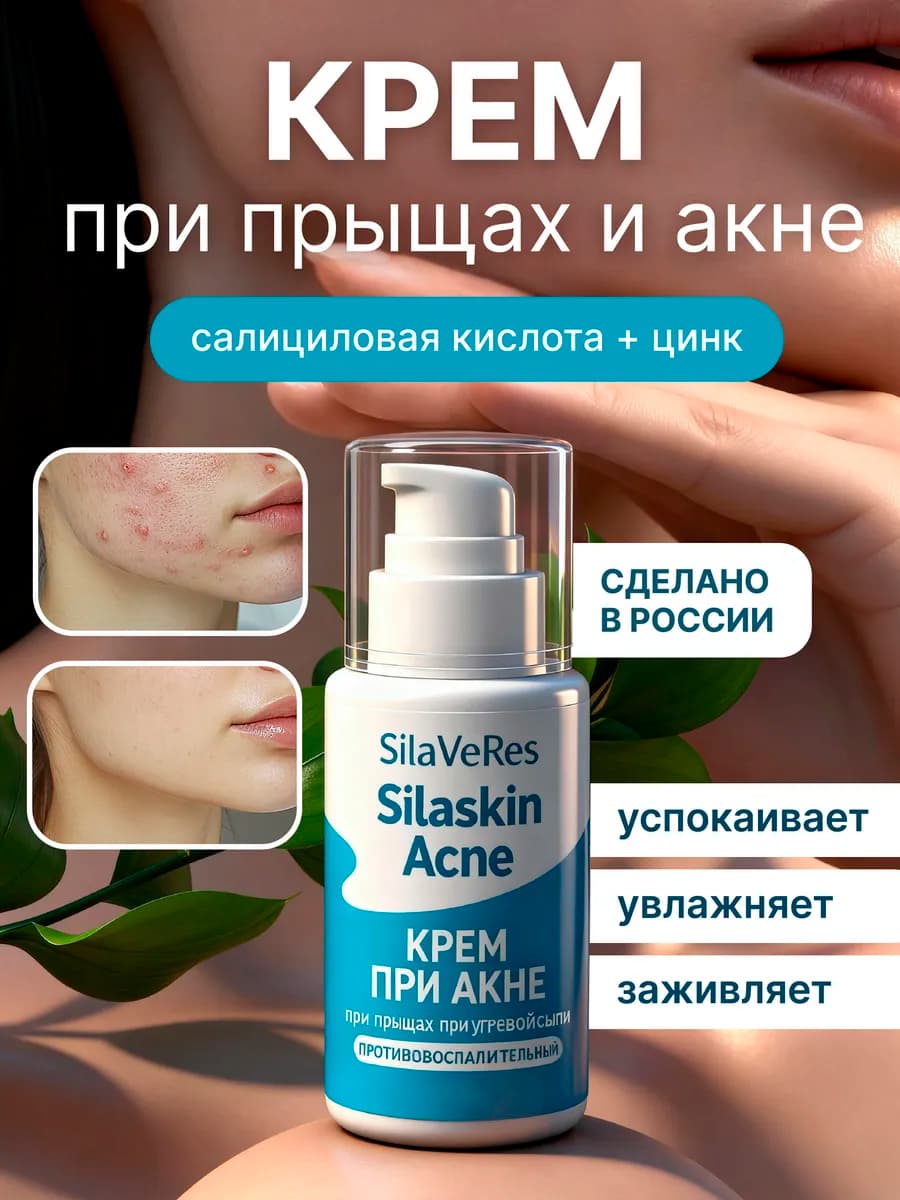 Салициловый крем от прыщей и акне с цинком