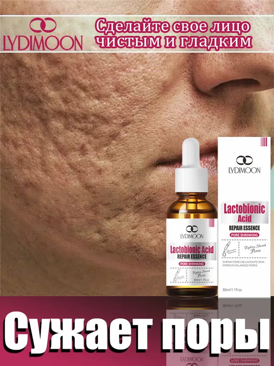 Сыворотка для лица, для сужения пор, против угрей 30 мл