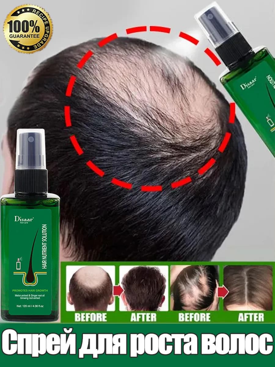 Мощный спрей для роста волос средство против выпадения