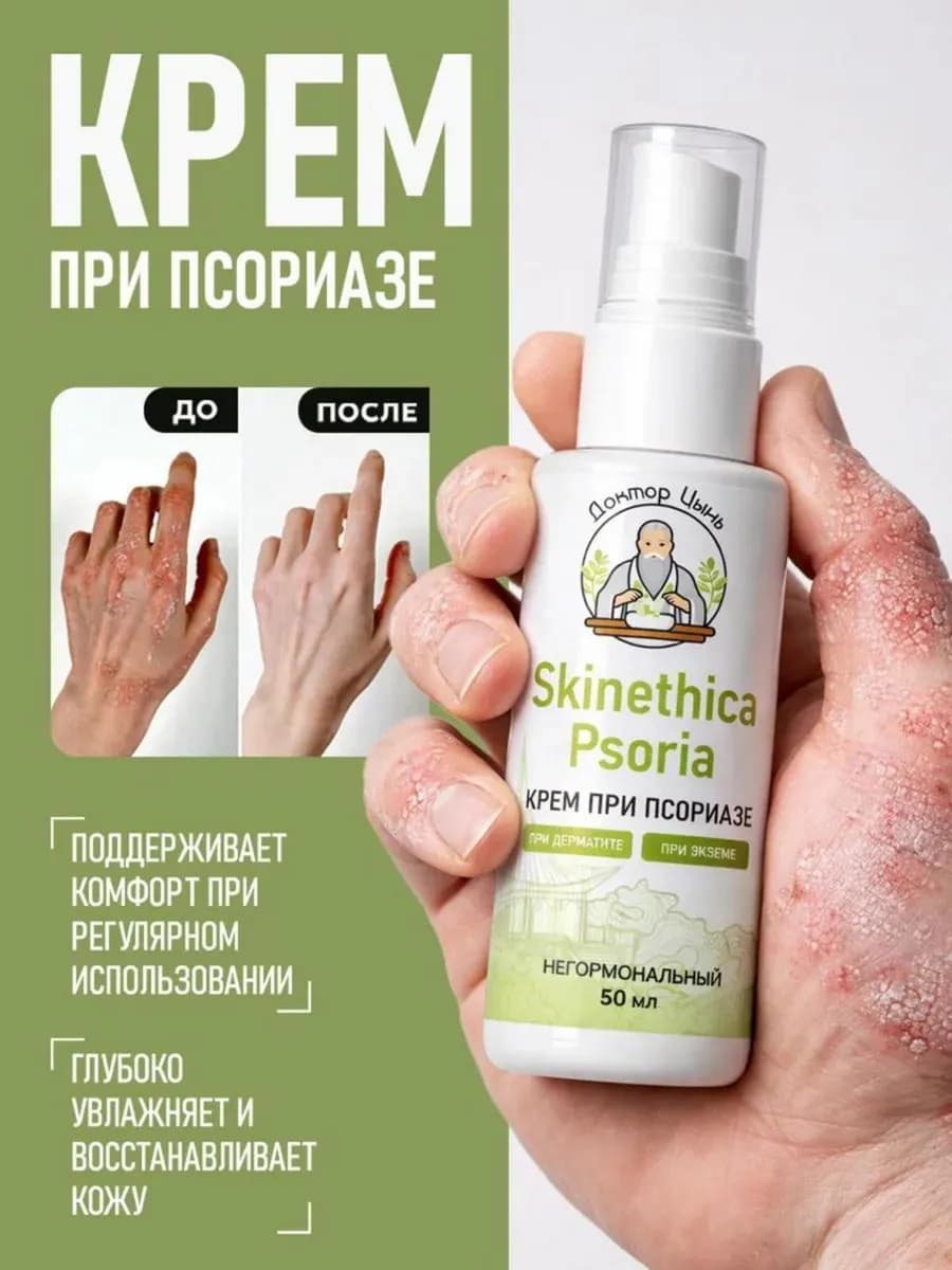 Крем от псориаза и экземы для лица и тела 50 мл