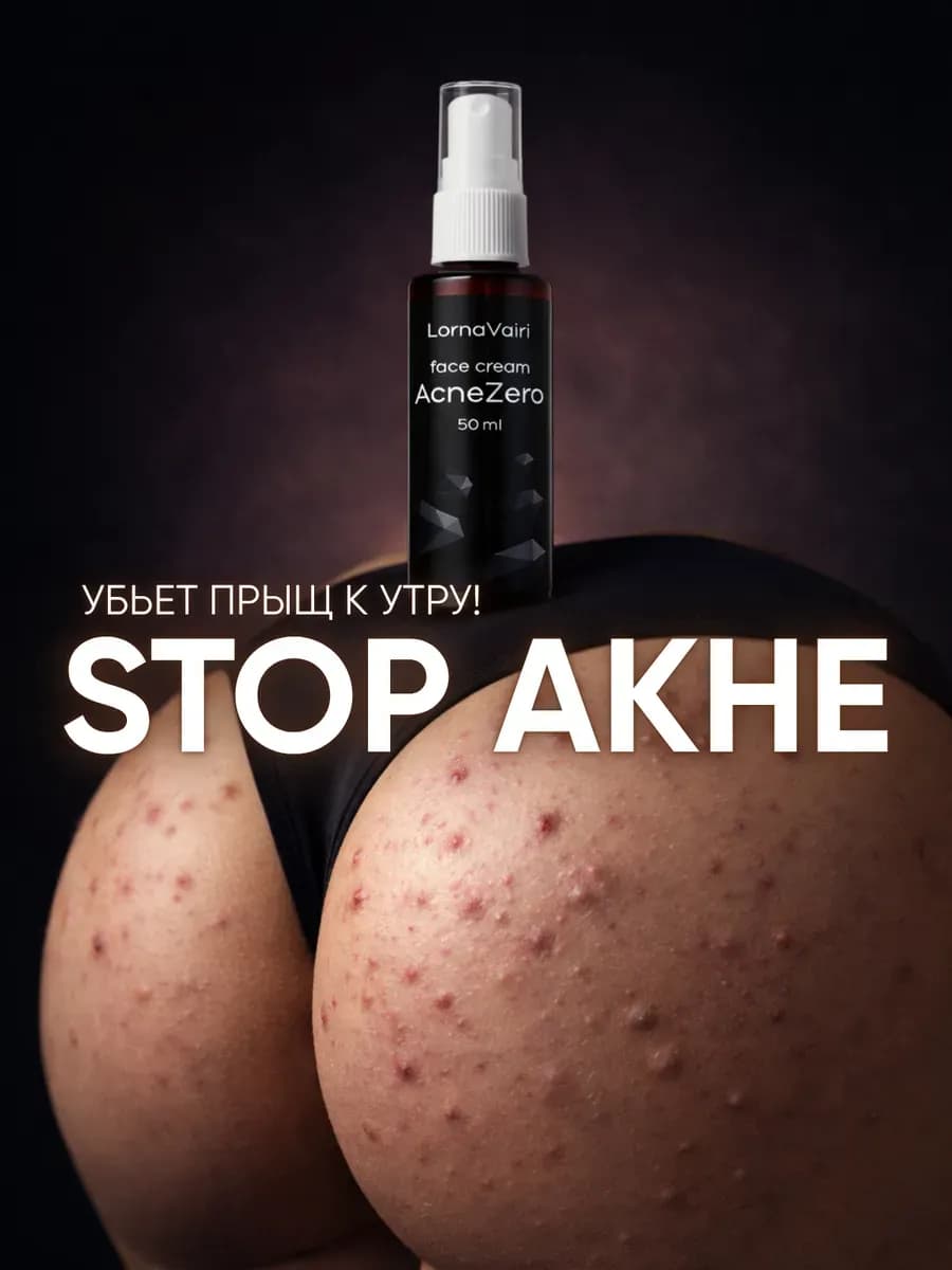Крем от прыщей и акне для лица