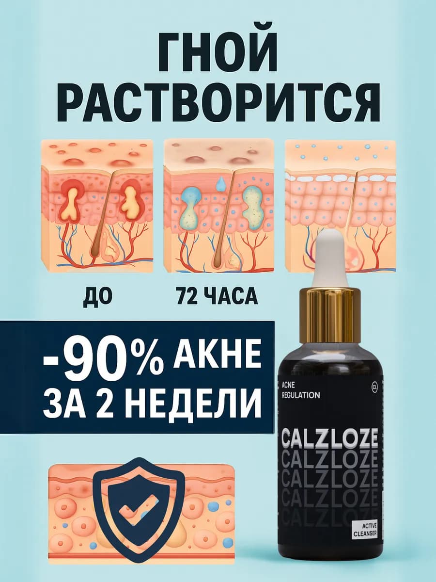 Сыворотка для лица от прыщей и акне с ниацинамидом