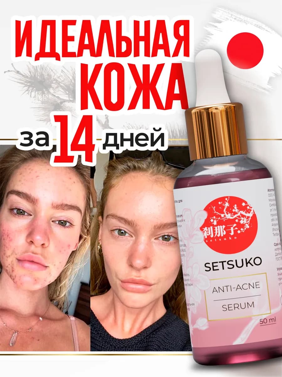 Сыворотка от прыщей и черных точек с ниацинамидом и цинком