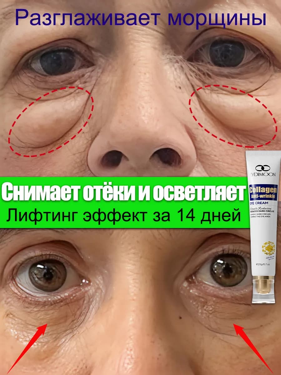 Крем для век вокруг глаз от отеков и темных круговот морщин