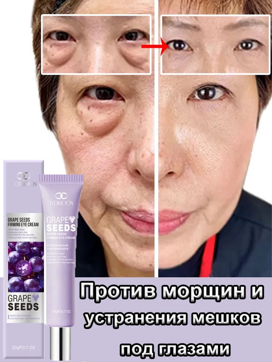 Крем для глаз от мешков и темных кругов