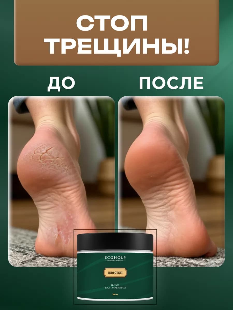 Крем для ног с мочевиной от трещин и натоптышей