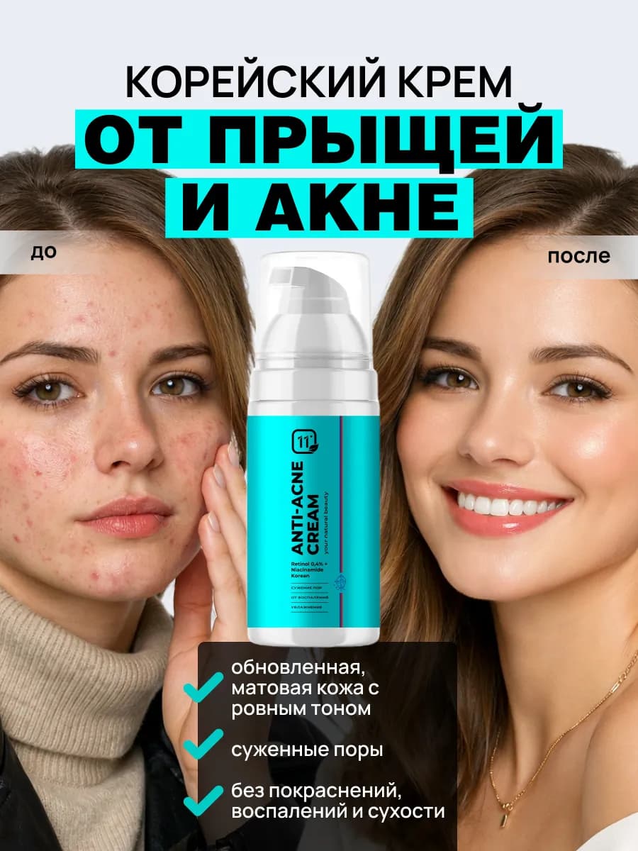 Крем-сыворотка от прыщей на лице Корея. С ретинолом и ниацин…