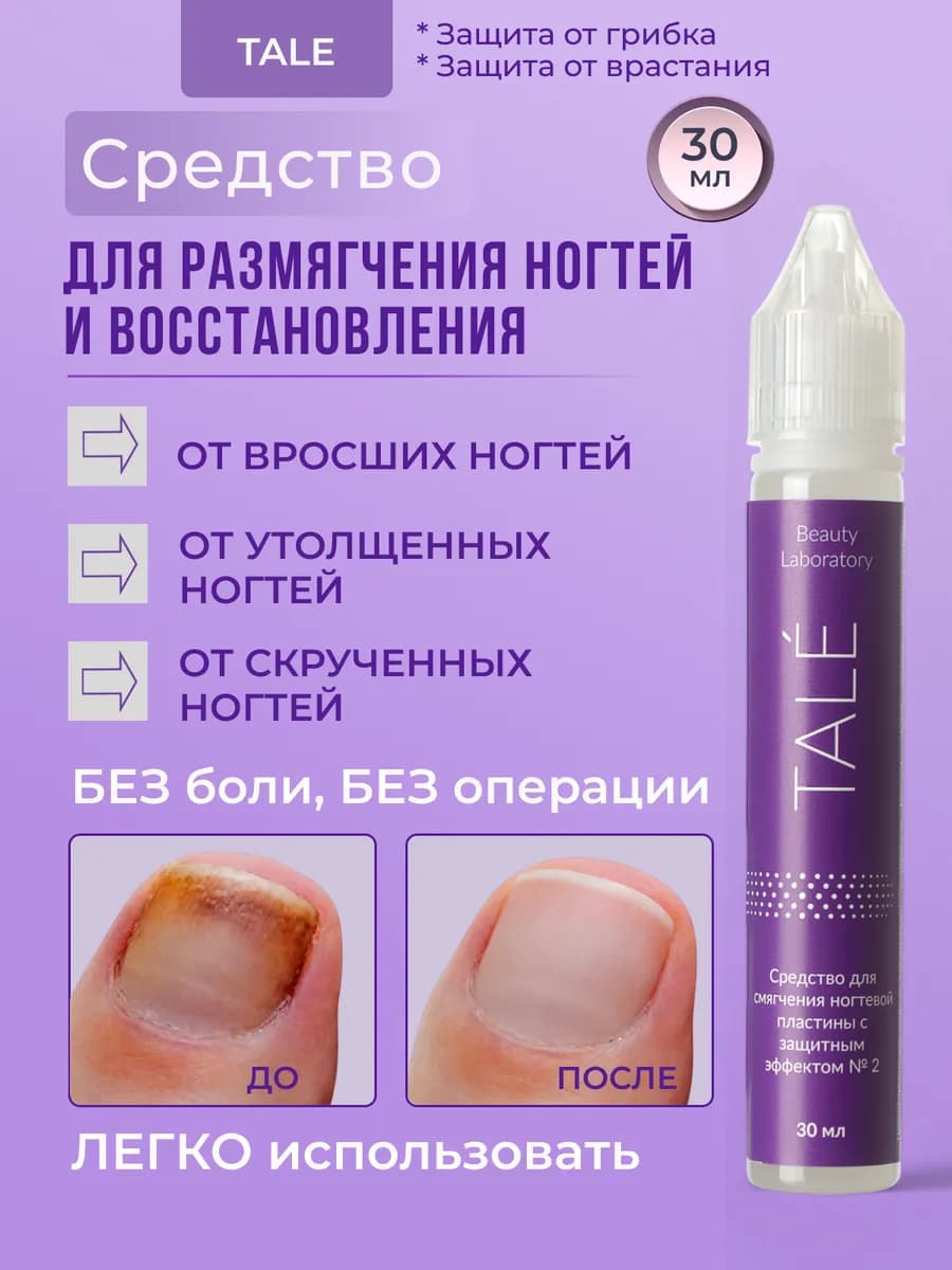Размягчитель для вросших ногтей на ногах руках лечение 30 мл