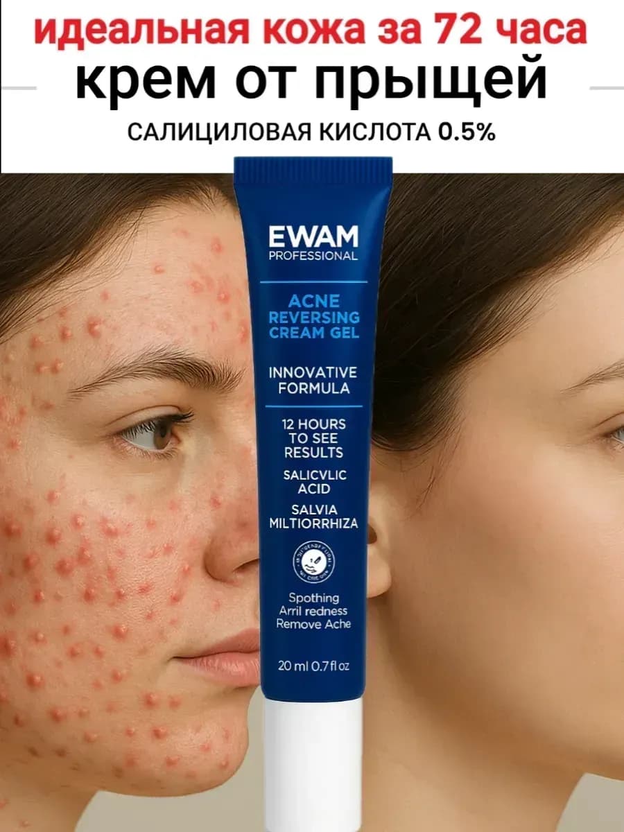 Крем от прыщей для лица с салициловой кислотой 0.5%