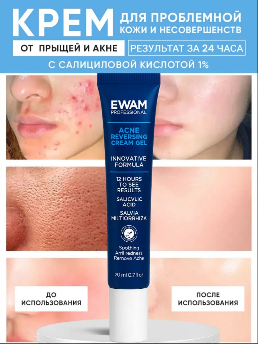 Крем от прыщей и акне на лице и теле 1%
