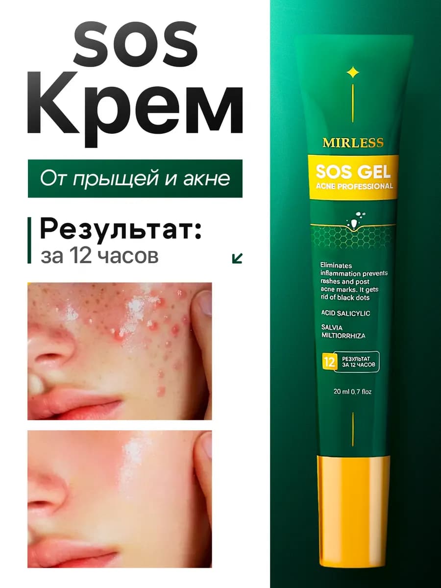 Крем от прыщей и акне с салициловой кислотой