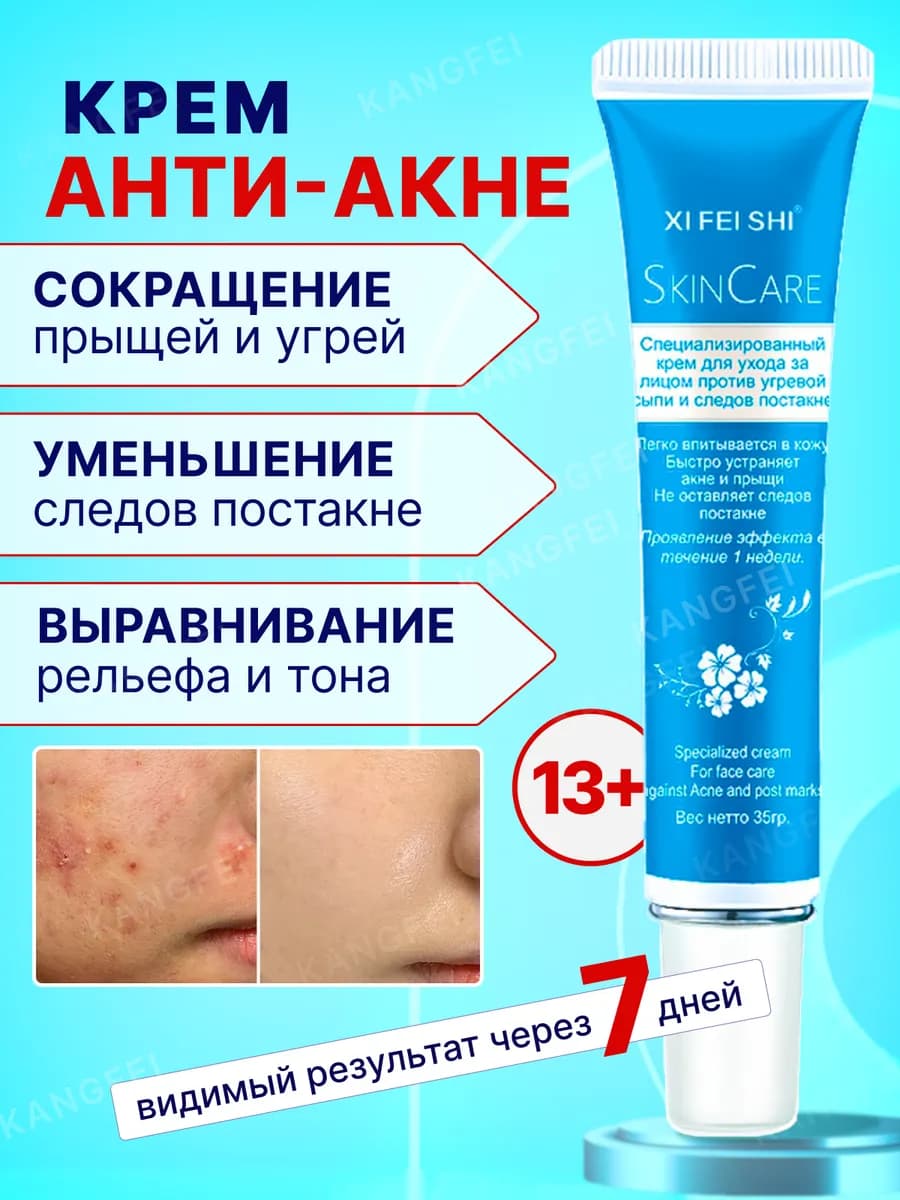 Крем от прыщей, акне и постакне на лице и теле