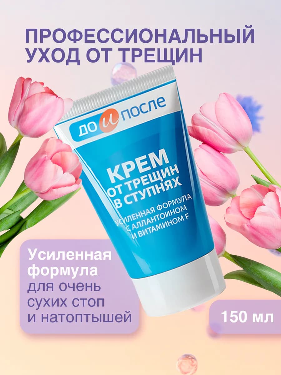 Увлажняющий крем для ног от трещин и сухости