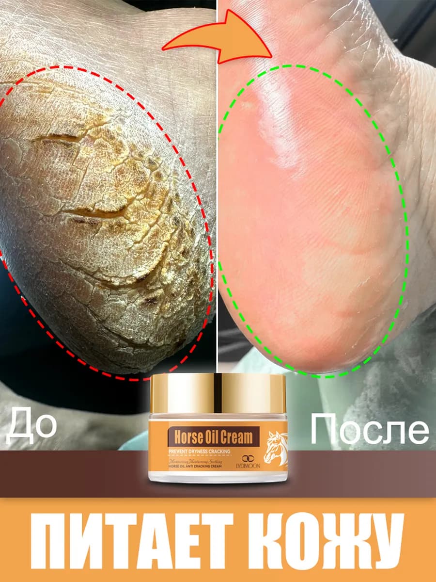 Косметика для ног от натоптышей и трещин на пятках