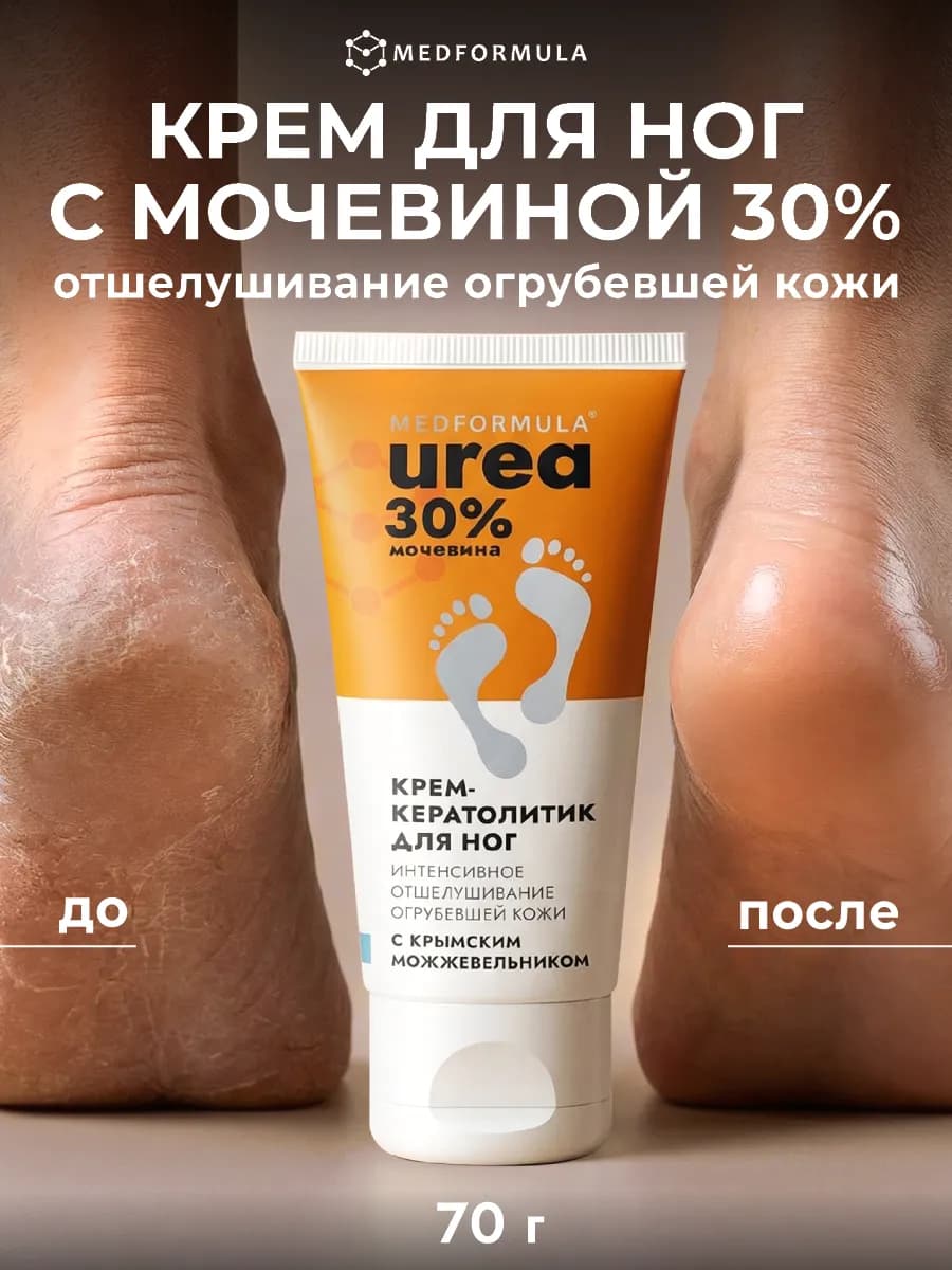 Натуральный крем для ног отшелушивающий с мочевиной