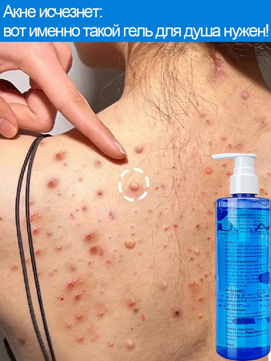 Гель для душа против прыщей и с антигрибковым эффектом 300 м…