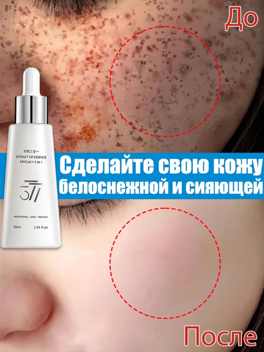 Сыворотка для лица Осветление от пигментации от морщин