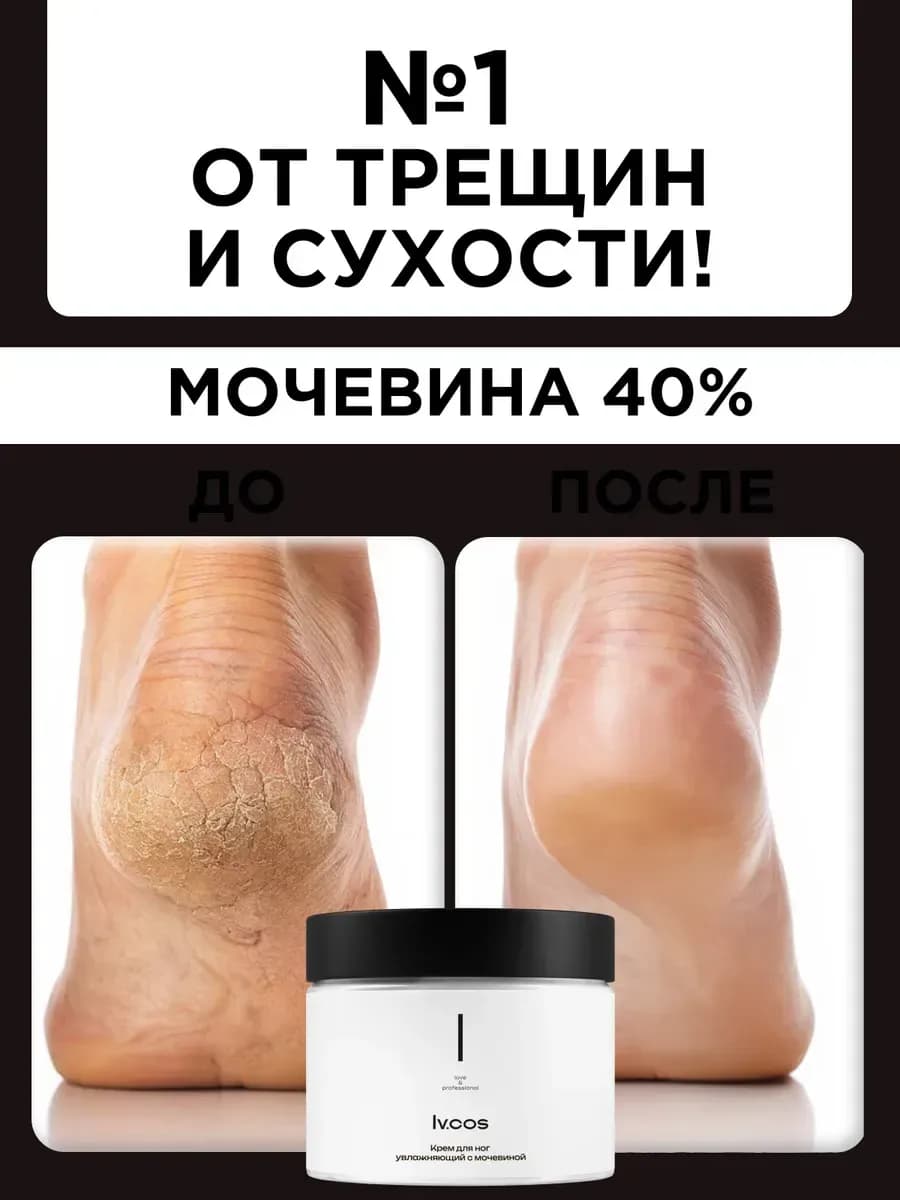 Крем для тела гель для ног с мочевиной