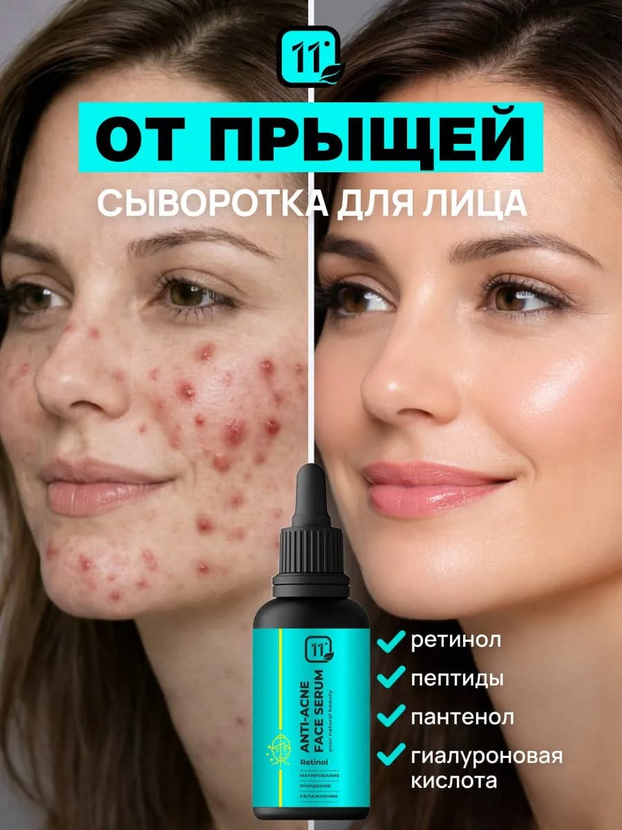 Сыворотка от прыщей для лица с ретинолом